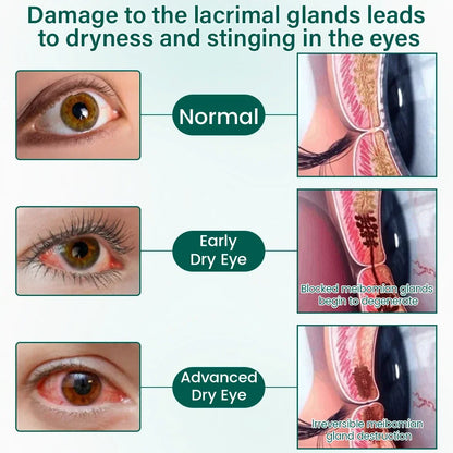 Ceoerty® OptiClear Nano Eye Roller Serum